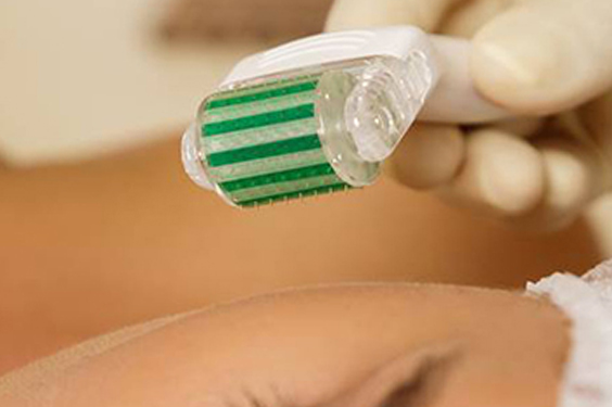 Imani Aesthetic and Laser Treatment. Best microneedling treatments clinic in lagos and abuja